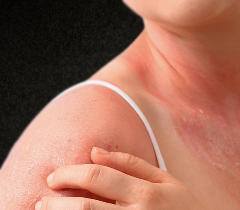 Common skin problems associated with cancer treatment: How to manage them