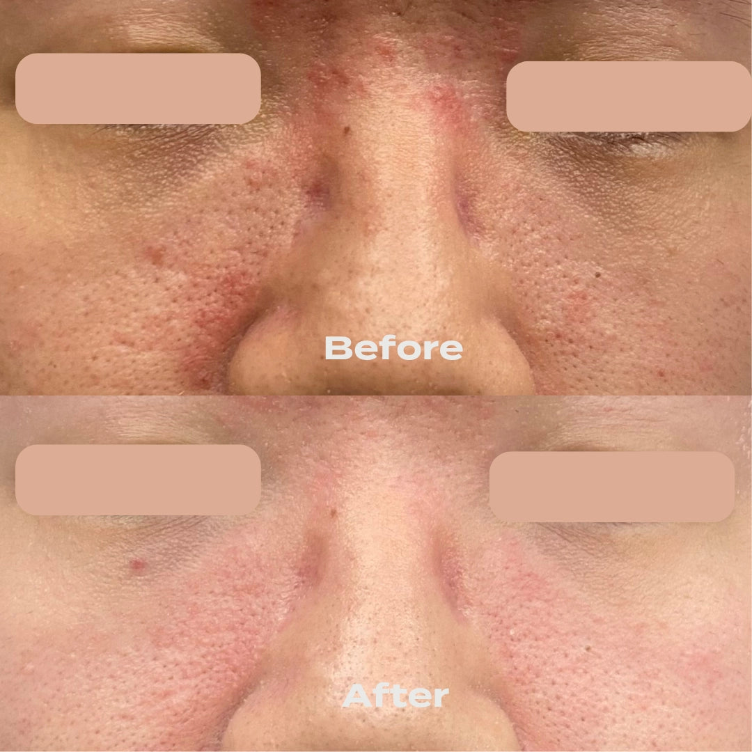 B-Restore Barrier Cream