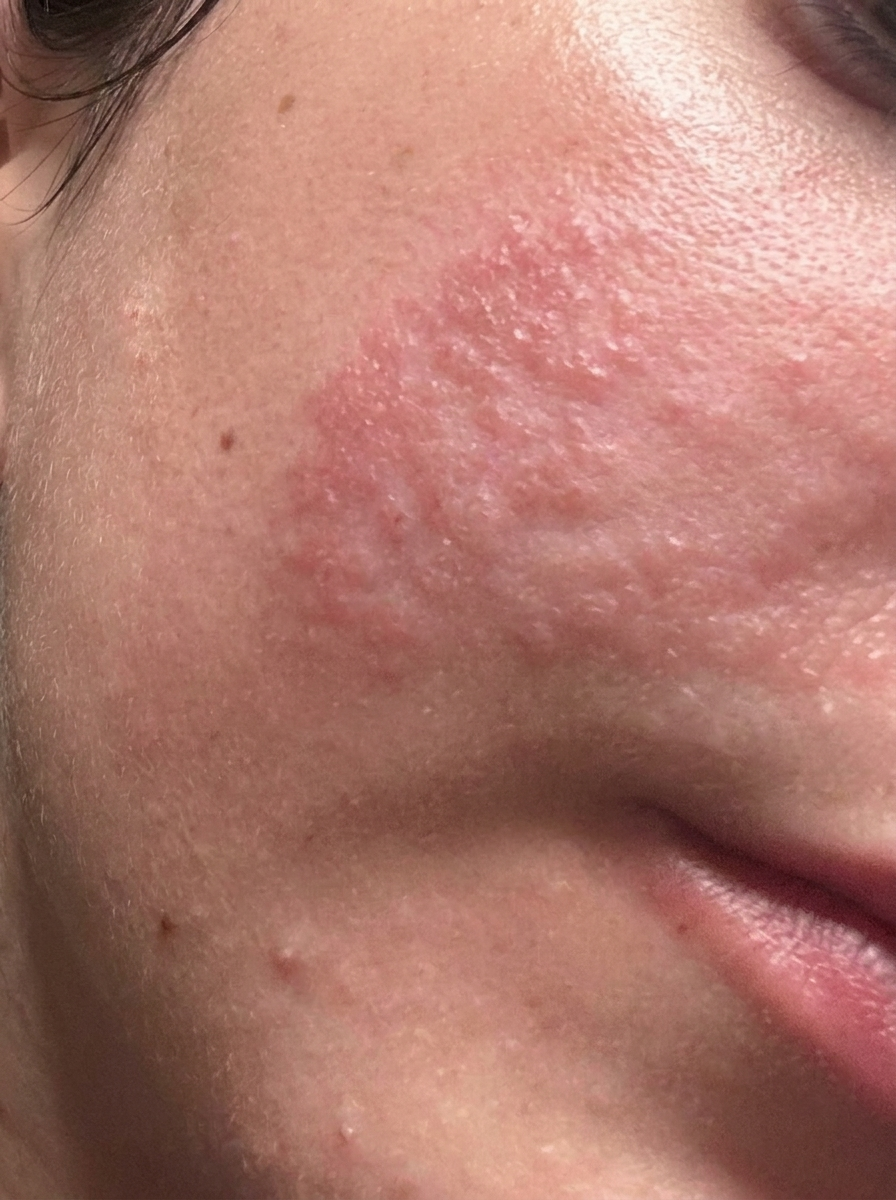 Dry, reactive patches