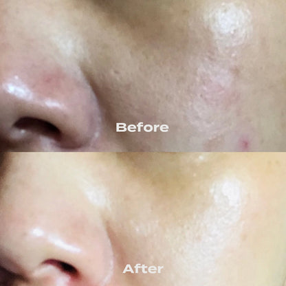 B-Restore Barrier Cream