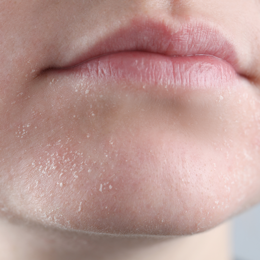 Hold moisture in
